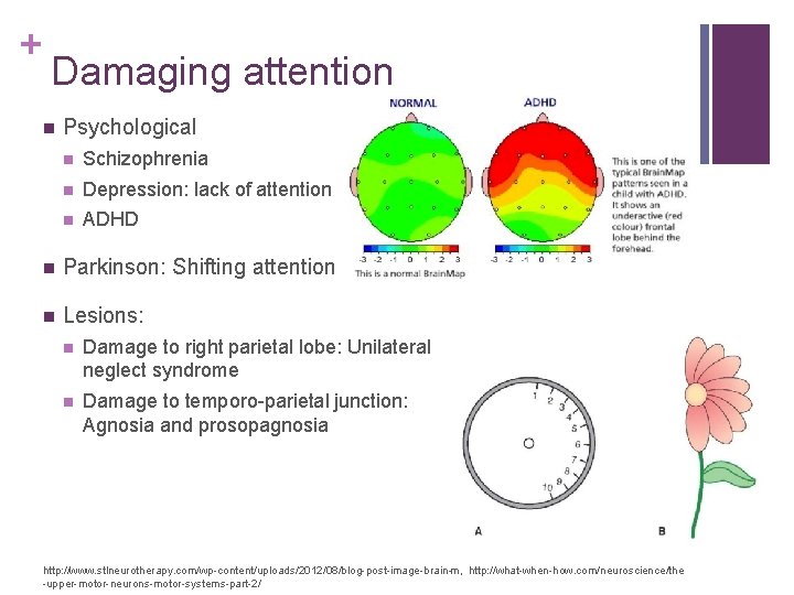 + Damaging attention n Psychological n Schizophrenia n Depression: lack of attention n ADHD