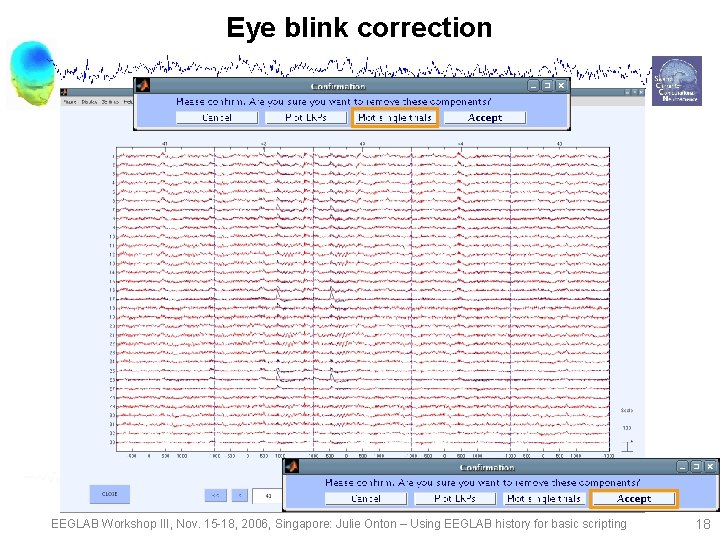 Eye blink correction EEGLAB Workshop III, Nov. 15 -18, 2006, Singapore: Julie Onton –