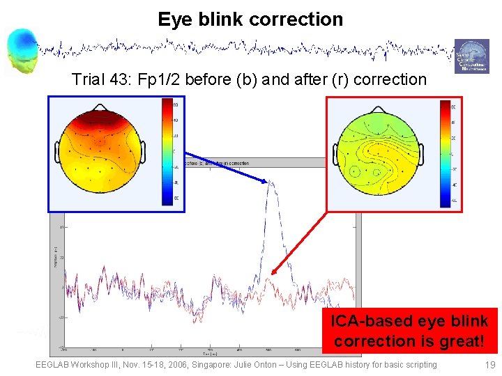 Eye blink correction Trial 43: Fp 1/2 before (b) and after (r) correction ICA-based