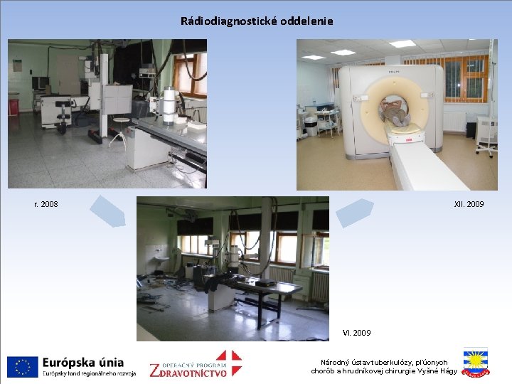 Rádiodiagnostické oddelenie r. 2008 XII. 2009 VI. 2009 Národný ústav tuberkulózy, pľúcnych chorôb a