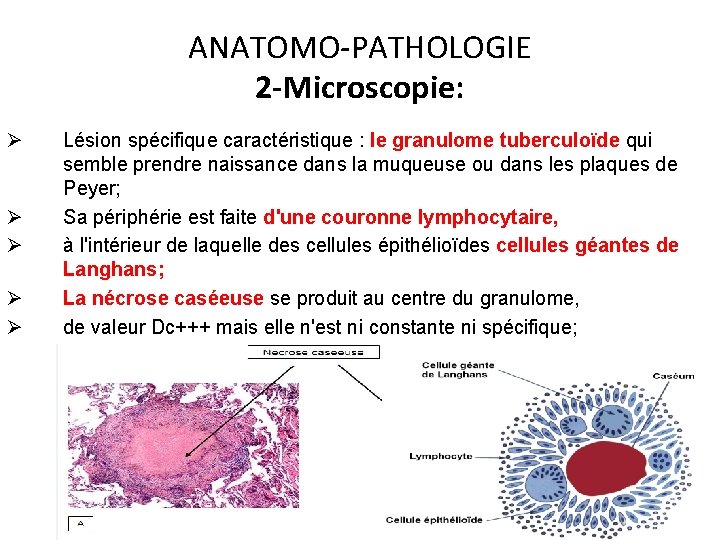 ANATOMO-PATHOLOGIE 2 -Microscopie: Ø Ø Ø Lésion spécifique caractéristique : le granulome tuberculoïde qui