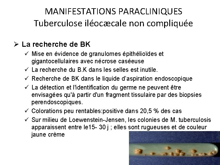 MANIFESTATIONS PARACLINIQUES Tuberculose iléocæcale non compliquée Ø La recherche de BK ü Mise en