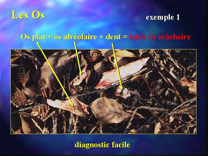 Les Os exemple 1 Os plat + os alvéolaire + dent = balle de