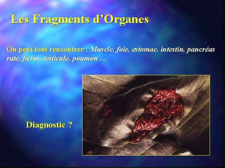 Les Fragments d’Organes On peut tout rencontrer : Muscle, foie, estomac, intestin, pancréas rate,