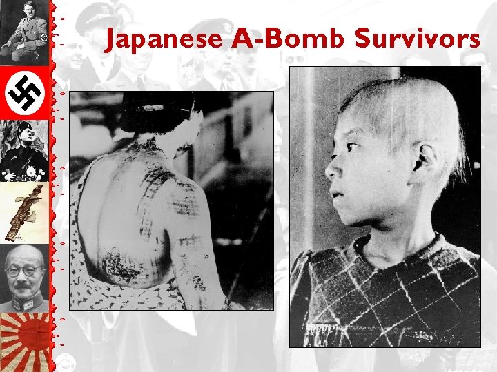 Japanese A-Bomb Survivors 