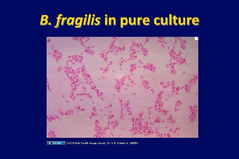 B. fragilis in pure culture CDC/Public Health Image Library, Dr. V. R. Dowell Jr.