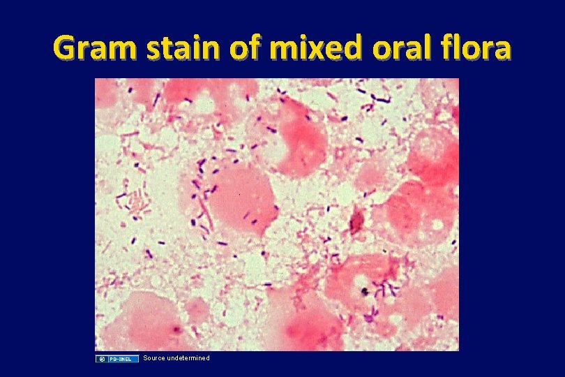Gram stain of mixed oral flora Source undetermined 