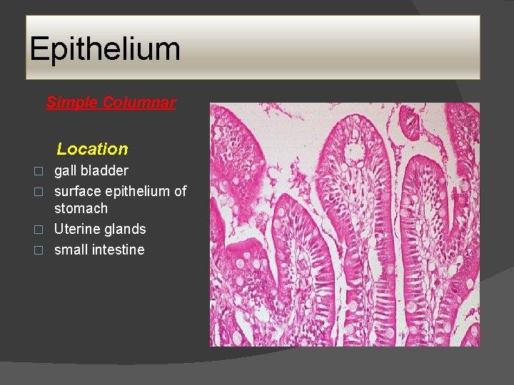 Epithelium Simple Columnar Location gall bladder � surface epithelium of stomach � Uterine glands Epithelium Simple Columnar Location gall bladder � surface epithelium of stomach � Uterine glands