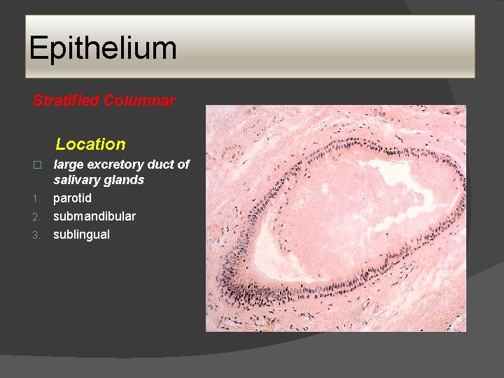 Epithelium Stratified Columnar Location large excretory duct of salivary glands 1. parotid 2. submandibular Epithelium Stratified Columnar Location large excretory duct of salivary glands 1. parotid 2. submandibular