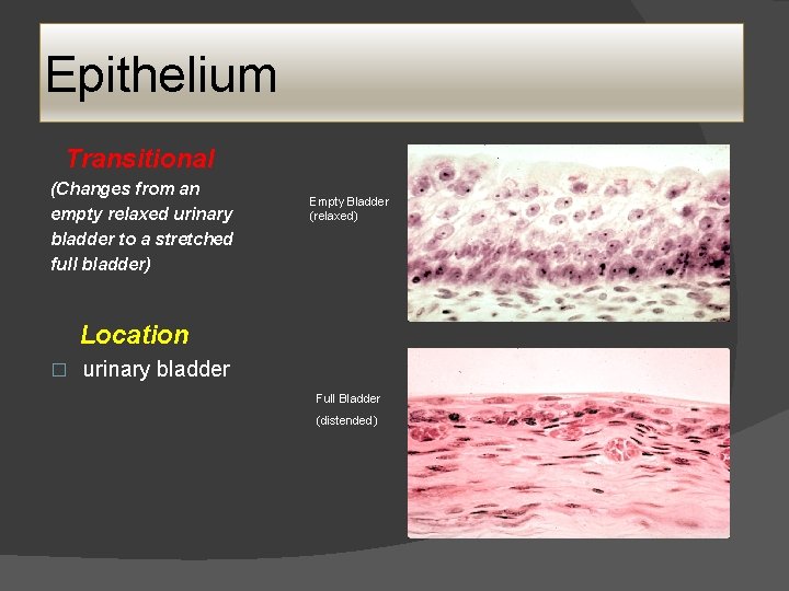 Epithelium Transitional (Changes from an empty relaxed urinary bladder to a stretched full bladder) Epithelium Transitional (Changes from an empty relaxed urinary bladder to a stretched full bladder)
