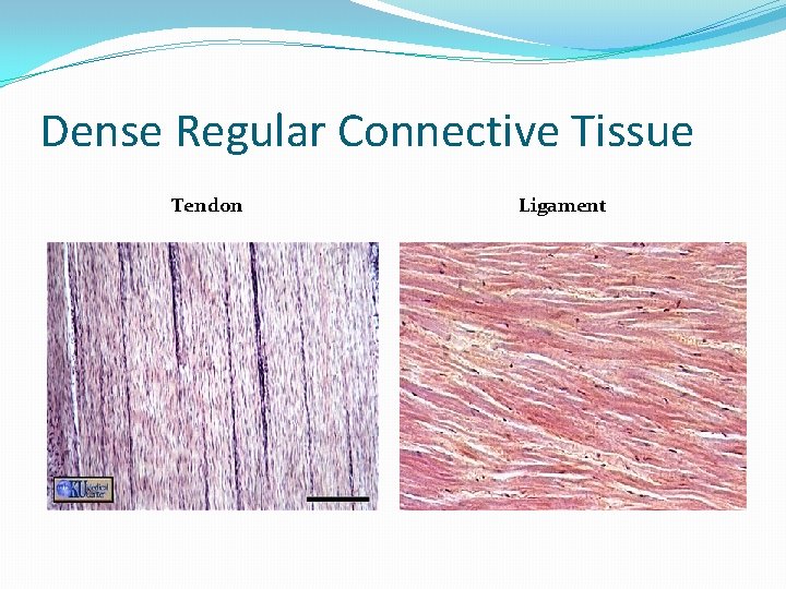 Dense Regular Connective Tissue Tendon Ligament Dense Regular Connective Tissue Tendon Ligament
