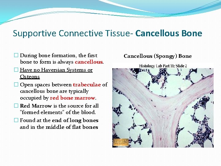 Supportive Connective Tissue- Cancellous Bone � During bone formation, the first bone to form Supportive Connective Tissue- Cancellous Bone � During bone formation, the first bone to form