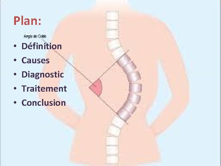 Plan: • • • Définition Causes Diagnostic Traitement Conclusion 