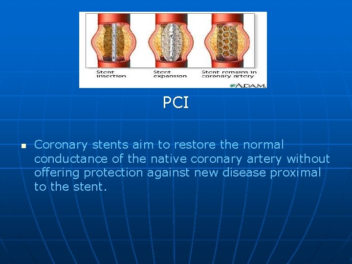 PCI n Coronary stents aim to restore the normal conductance of the native coronary