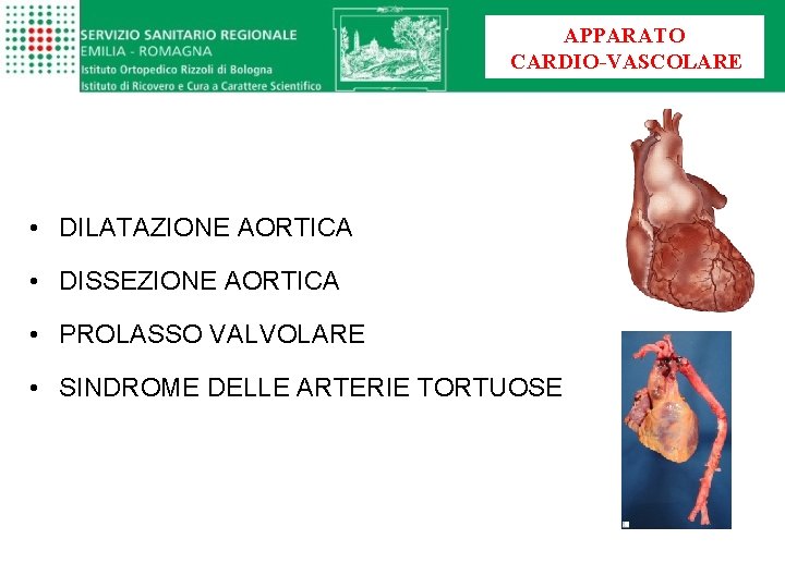 APPARATO CARDIO-VASCOLARE • DILATAZIONE AORTICA • DISSEZIONE AORTICA • PROLASSO VALVOLARE • SINDROME DELLE