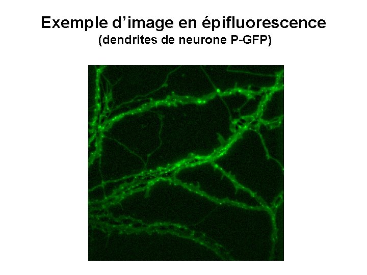 Exemple d’image en épifluorescence (dendrites de neurone P-GFP) 