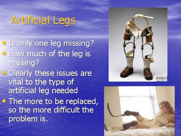 Artificial Legs • Is only one leg missing? • How much of the leg