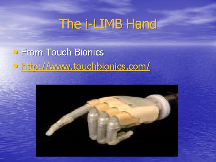  The i-LIMB Hand • From Touch Bionics • http: //www. touchbionics. com/ 