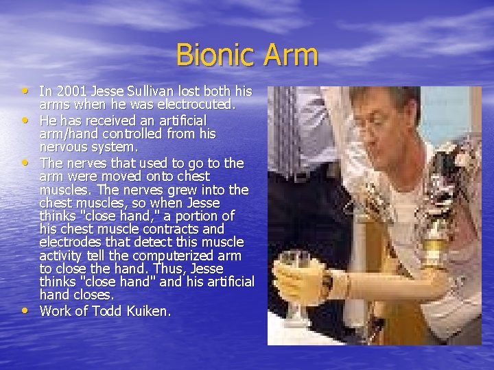 Bionic Arm • In 2001 Jesse Sullivan lost both his • • • arms