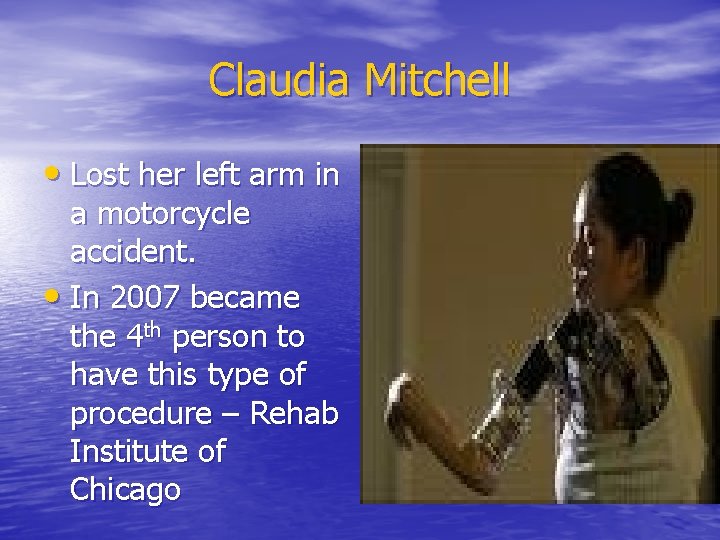 Claudia Mitchell • Lost her left arm in a motorcycle accident. • In 2007