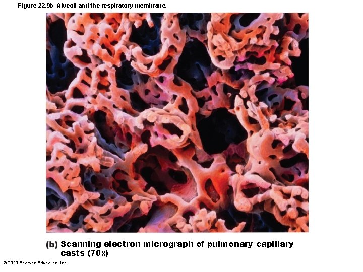 Figure 22. 9 b Alveoli and the respiratory membrane. Scanning electron micrograph of pulmonary