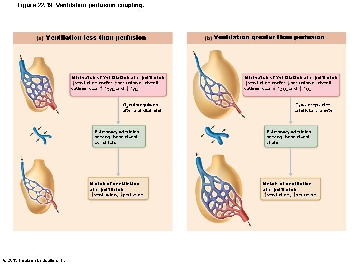 Figure 22. 19 Ventilation-perfusion coupling. Ventilation less than perfusion Mismatch of ventilation and perfusion
