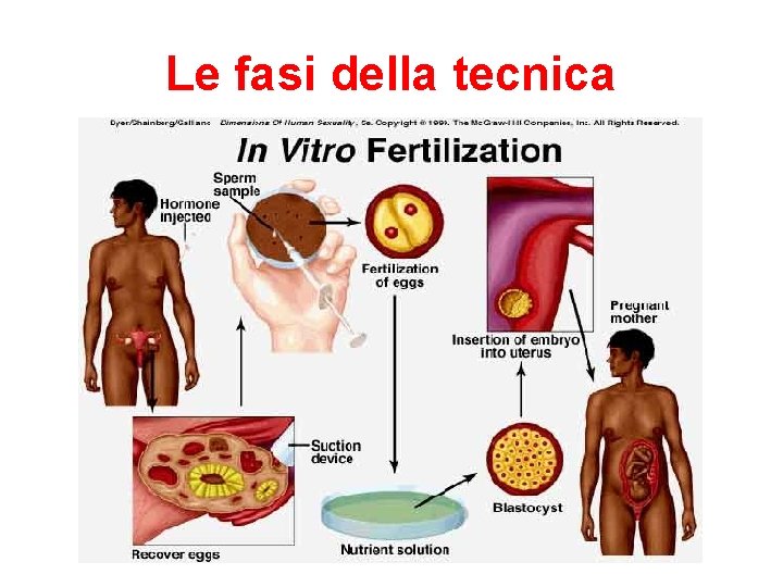 Le fasi della tecnica 