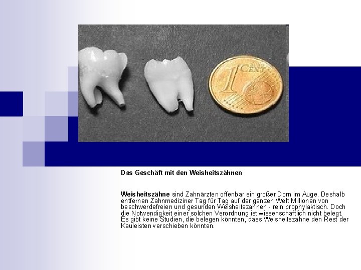 Das Geschäft mit den Weisheitszähne sind Zahnärzten offenbar ein großer Dorn im Auge. Deshalb Das Geschäft mit den Weisheitszähne sind Zahnärzten offenbar ein großer Dorn im Auge. Deshalb