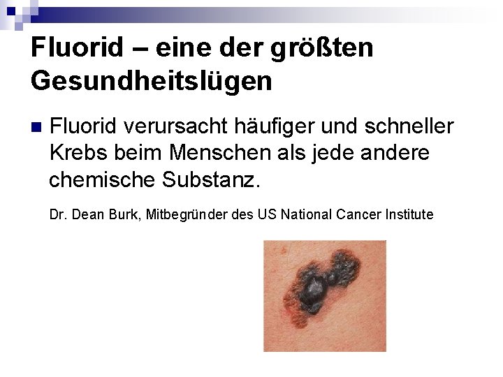 Fluorid – eine der größten Gesundheitslügen n Fluorid verursacht häufiger und schneller Krebs beim Fluorid – eine der größten Gesundheitslügen n Fluorid verursacht häufiger und schneller Krebs beim