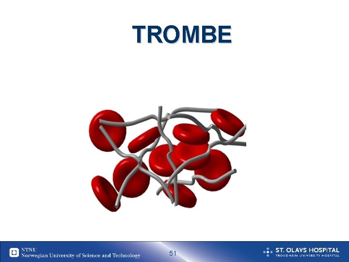 TROMBE 51 