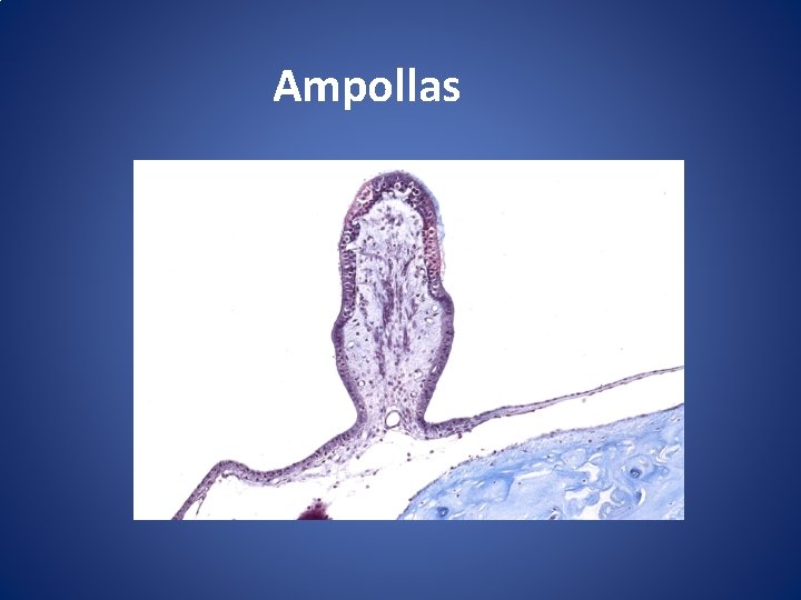 Ampollas 