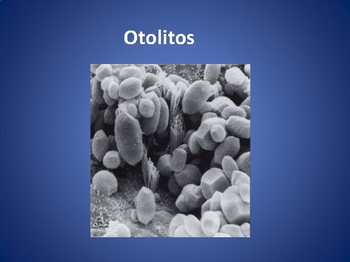 Otolitos 