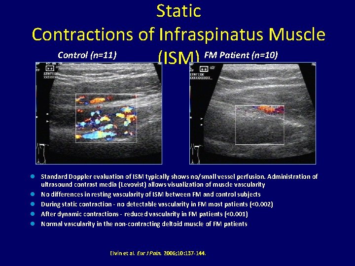 Static Contractions of Infraspinatus Muscle Control (n=11) (ISM) FM Patient (n=10) n n n