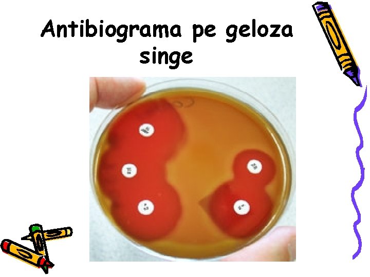 Antibiograma pe geloza singe 