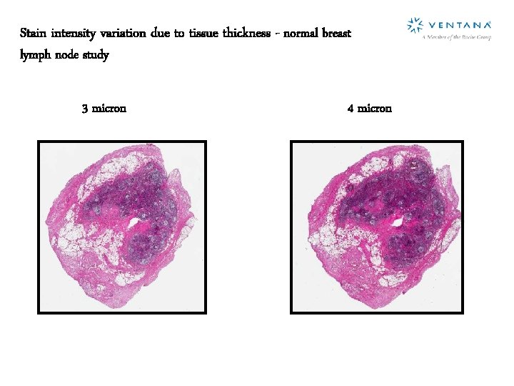 Stain intensity variation due to tissue thickness - normal breast lymph node study 3