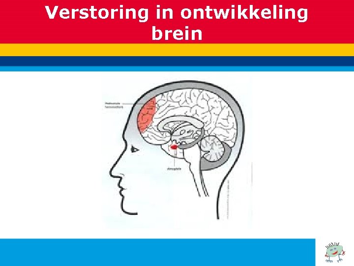 Verstoring in ontwikkeling brein 