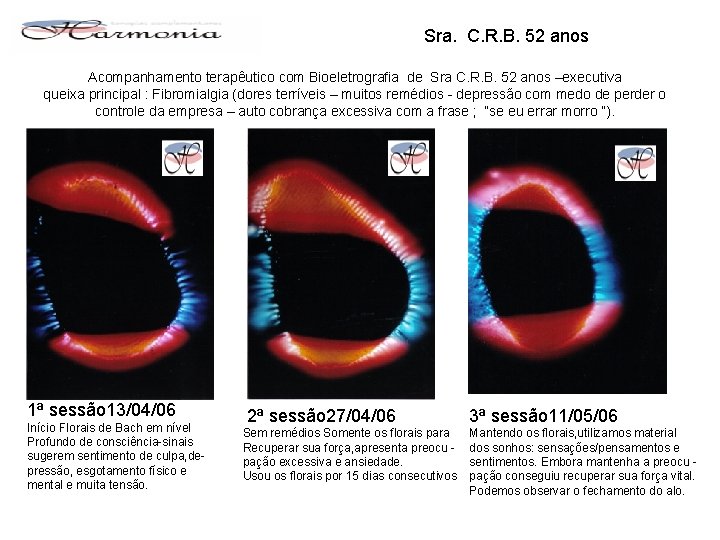 Sra. C. R. B. 52 anos Acompanhamento terapêutico com Bioeletrografia de Sra C. R.