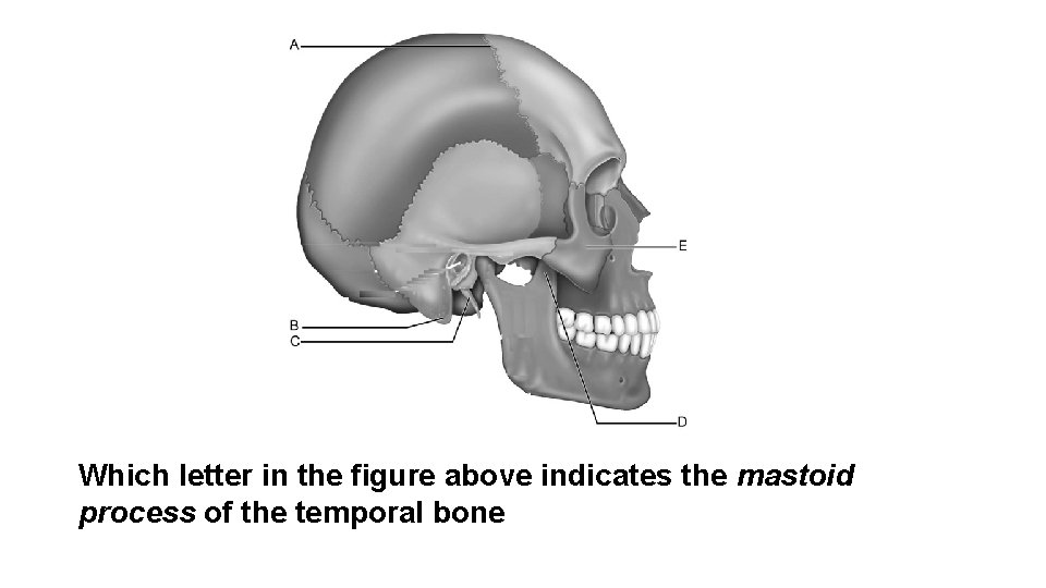 Which letter in the figure above indicates the mastoid process of the temporal bone