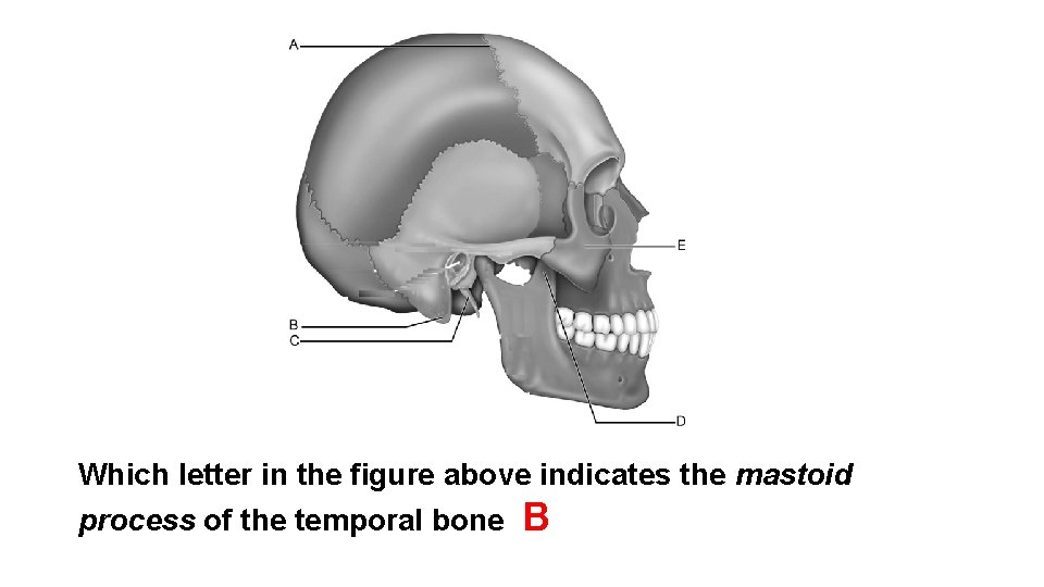 Which letter in the figure above indicates the mastoid process of the temporal bone