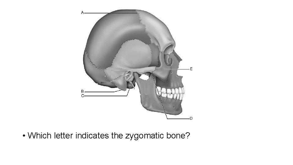  • Which letter indicates the zygomatic bone? 