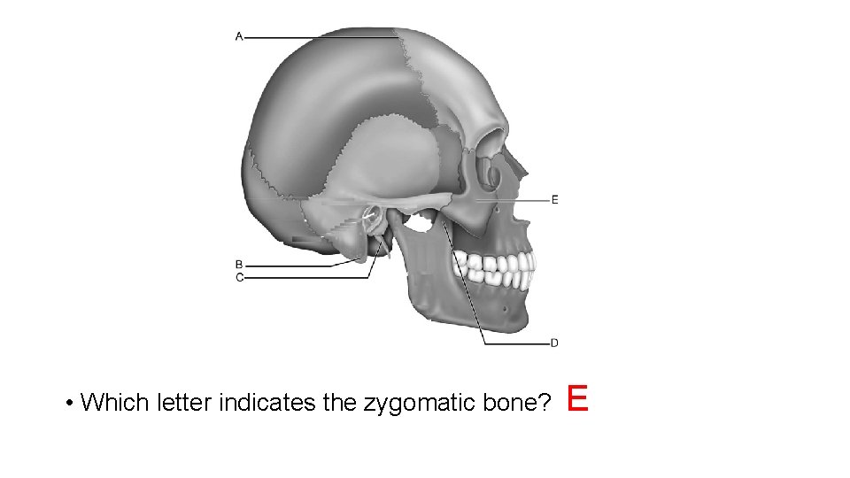  • Which letter indicates the zygomatic bone? E 