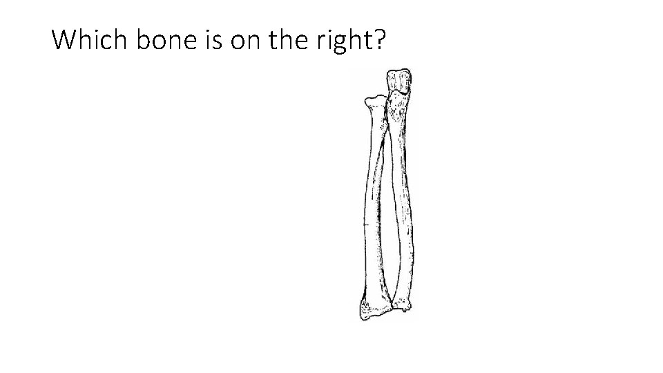 Which bone is on the right? 