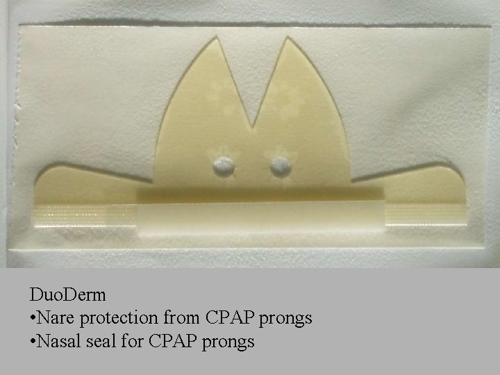 Duo. Derm • Nare protection from CPAP prongs • Nasal seal for CPAP prongs