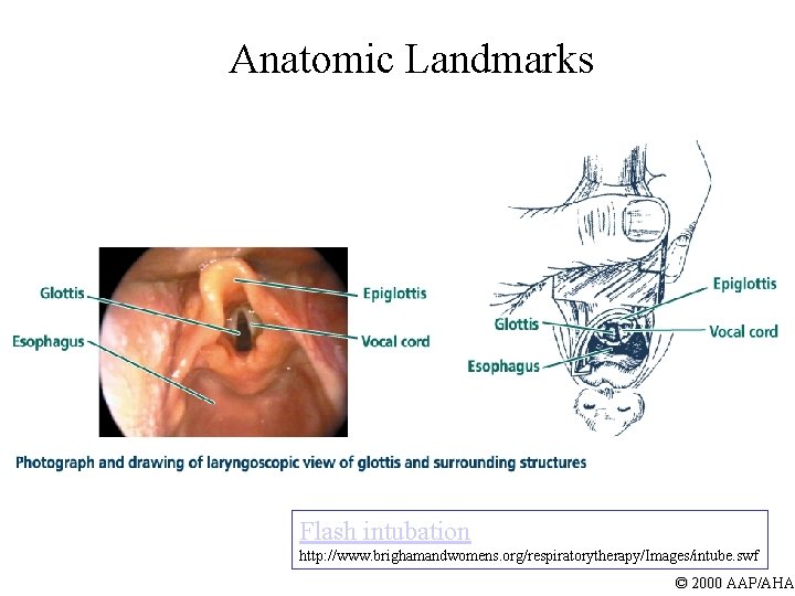Anatomic Landmarks Flash intubation http: //www. brighamandwomens. org/respiratorytherapy/Images/intube. swf © 2000 AAP/AHA 