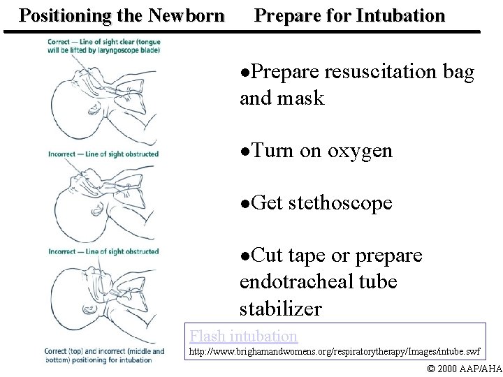 Positioning the Newborn Prepare for Intubation l. Prepare resuscitation bag and mask l. Turn