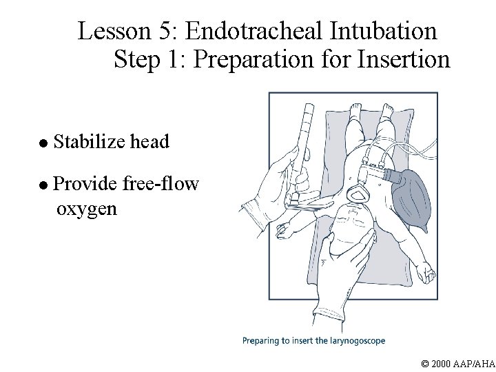 Lesson 5: Endotracheal Intubation Step 1: Preparation for Insertion l Stabilize head l Provide