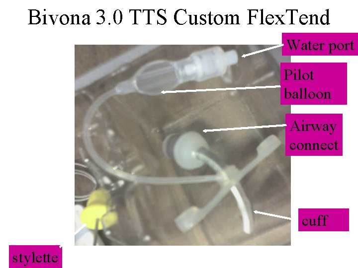 Bivona 3. 0 TTS Custom Flex. Tend Water port Pilot balloon Airway connect cuff