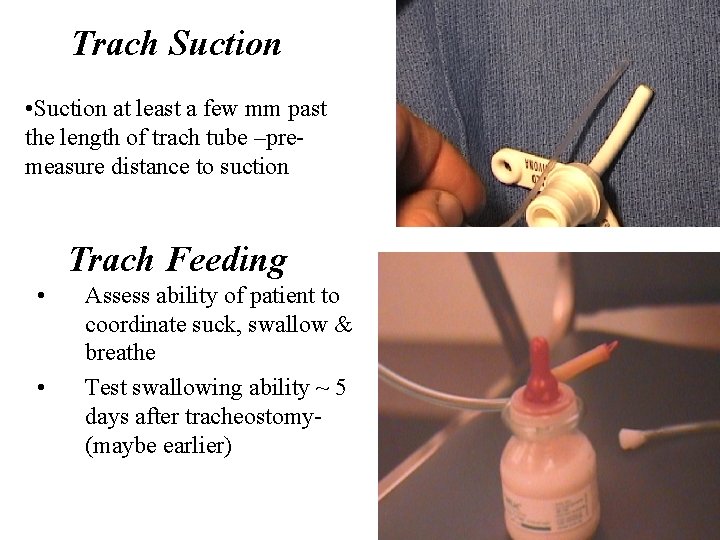 Trach Suction • Suction at least a few mm past the length of trach