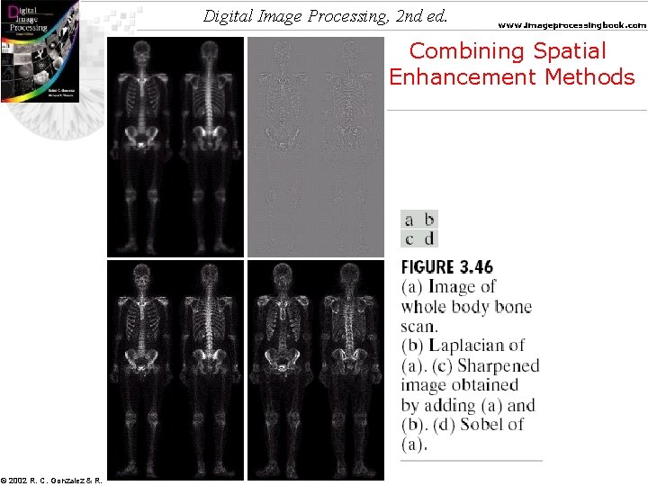 Digital Image Processing, 2 nd ed. www. imageprocessingbook. com Combining Spatial Enhancement Methods ©