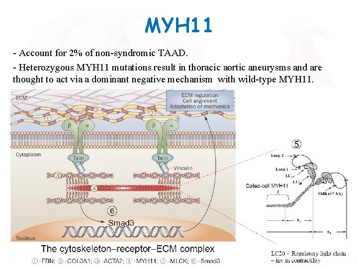 MYH 11 - Account for 2% of non-syndromic TAAD. - Heterozygous MYH 11 mutations